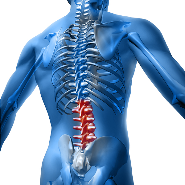 Lumbar Spondylosis